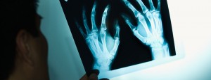 Doctor holding up x-ray for rehabilitation