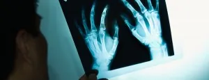 Clinician examining an X-ray of hands