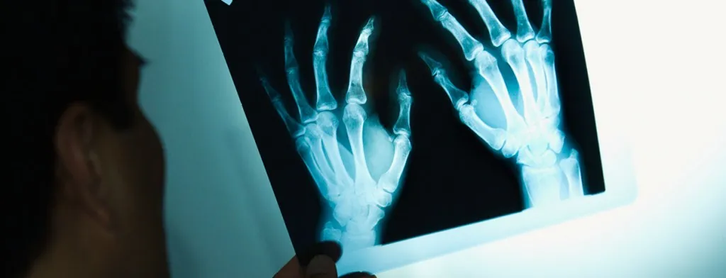 Clinician examining an X-ray of hands