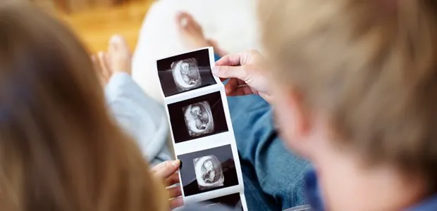 Couple looking at ultrasound images