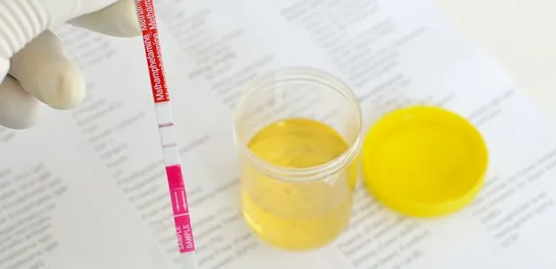 Urine sample container and testing materials
