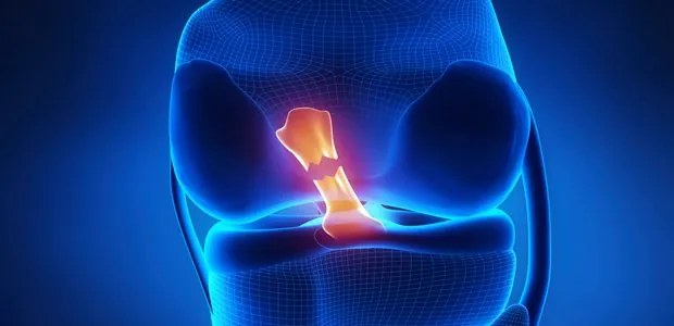 Illustration highlighting a knee ligament