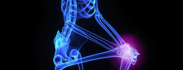 Anatomical illustration highlighting a knee joint